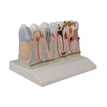 Modèle dentaire mâchoire inférieure, grossi 4 fois D250 Erler Zimmer