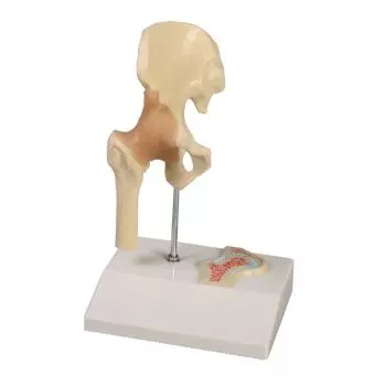 Articulation miniature de la hanche avec coupe transversale Erler Zimmer