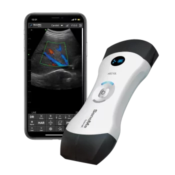 Echographe ultraportable connecté Bionet SonoMe