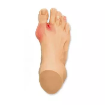 Modèle de blessures courantes du pied R10035 Erler Zimmer