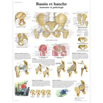 Planche anatomique Bassin et hanche - Anatomie et pathologie VR2172L