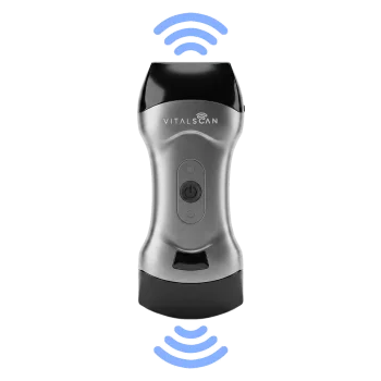 Echographe ultraportable connecté Vital Scan X5