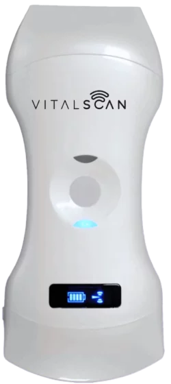 Echographe ultraportable connecté Vital Scan X5