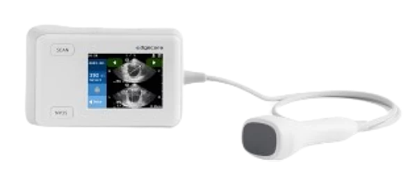 Bladder scanner / Scanner vésical Edgeflow UH10