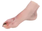 Modèle de pied blessé avec syndrome du pied diabétique Erler Zimmer