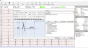 ECG numérique Spengler Cardiomate PC-ECG (12 pistes)
