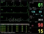 Moniteur patient multiparamétrique GIMA PC-3000 (PNI, SpO2, Temp., Resp, ECG)