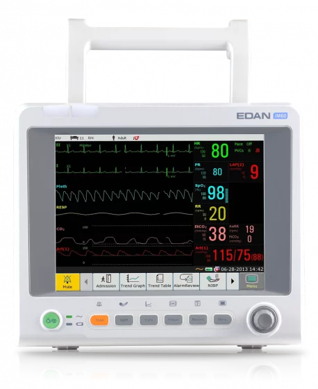 Moniteur de surveillance EDAN IM60