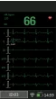 Moniteur de surveillance portable M850 SPO2-ECG 