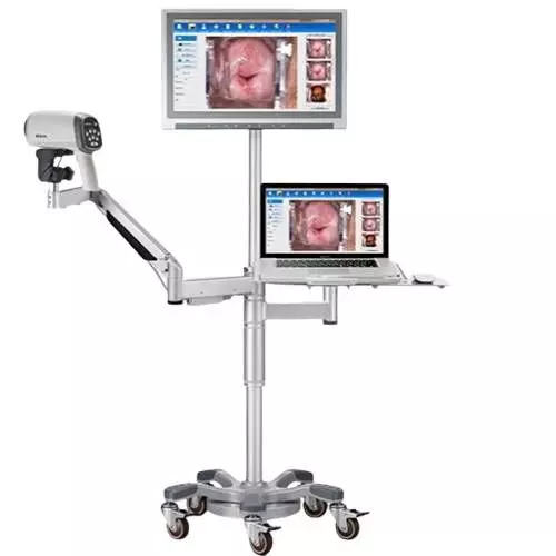 Vidéo Colposcope Edan C6A HD standard avec chariot T shape