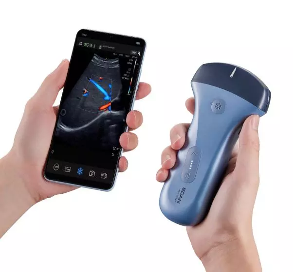 Echographe ultraportable connecté Edan Nano pour smartphone et tablette (couleur)