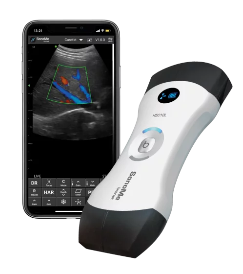 Echographe ultraportable connecté Bionet SonoMe