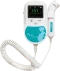 Doppler fœtal et vasculaire de poche Sonoline C (avec sonde 2, 3 ou 8 Mhz)
