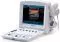 Echographe portable à ultrasons Edan U50 (couleur)