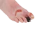Modèle de pied blessé avec syndrome du pied diabétique Erler Zimmer