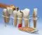Modèle de prothèse dentaire, en 7 parties, agrandie 10 fois - Allemand W42528