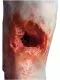 Modèle de jambe avec blessure par balle Erler Zimmer R50020