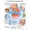 Planche anatomique Les affections rhumatismales VR2124L