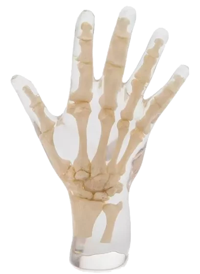 Fantôme radiographique de la main Erler Zimmer