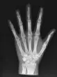 Fantôme radiographique avant-bras Erler Zimmer