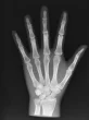 Fantôme radiographique de la main Erler Zimmer