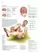Planche anatomique Epilepsie VR2626L