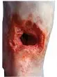Modèle de jambe avec blessure par balle Erler Zimmer R50020