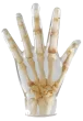 Fantôme radiographique de la main Erler Zimmer