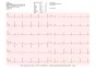 Electrocardiographe ECG Cardioline Touchecg HD+ Bluetooth (12 pistes) pour PC ou tablette Windows