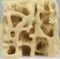 Modèle de comparaison ostéoporose avec os sain 4062 Erler Zimmer