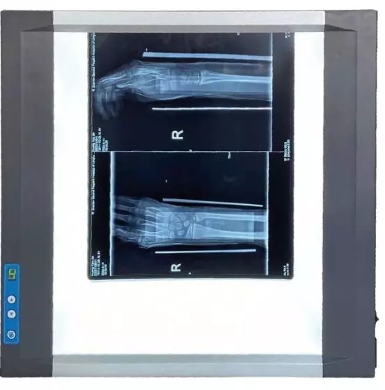 Négatoscopes LED extra-plat Devatoscope avec variateur (1 ou 2 plages)
