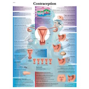 Planche anatomique Contraception VR2591UU