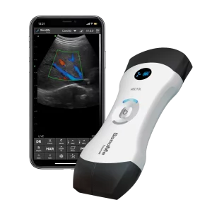 Echographe ultraportable connecté Bionet SonoMe