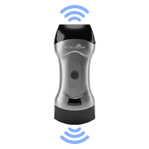 Echographe ultraportable connecté Vital Scan X5