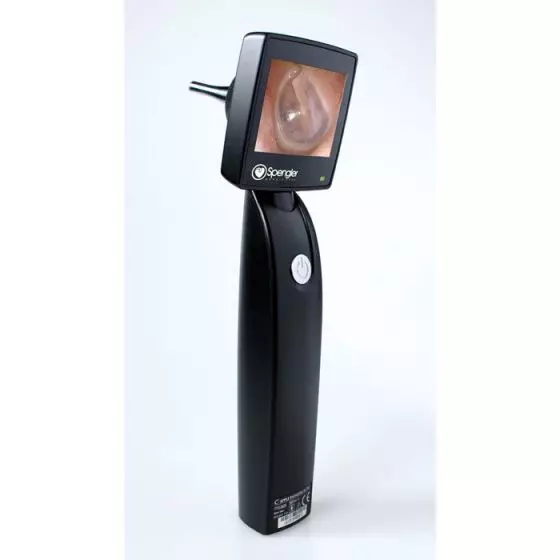 Otoscope vidéo Otoscreen 2 Spengler