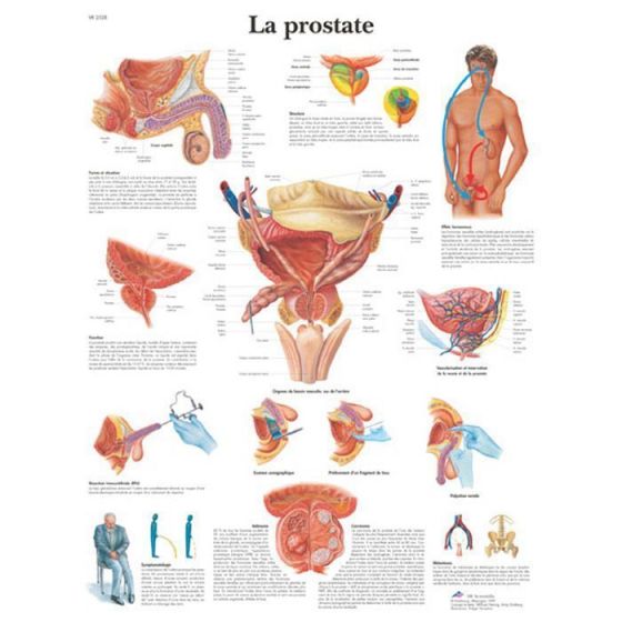 Planche anatomique La prostate 3B Scientific VR2528L