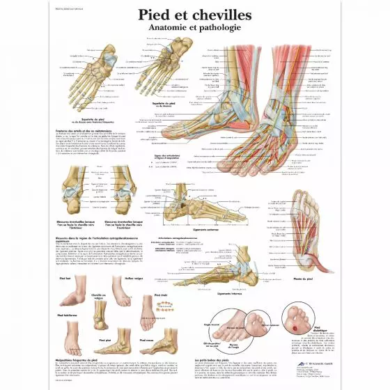 Planche anatomique Pied et chevilles - Anatomie et pathologie VR2176L