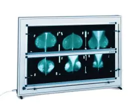 Négatoscope de mammographie à LED DXHM avec variateur ( 1,2,3,4,5 plages)