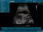 Echographe portable à ultrasons Edan U50 (couleur)