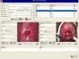 Logiciel de colposcopie pour Colpro, Colpy