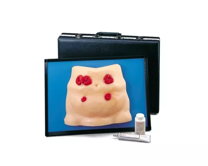 Simulateur de Stomie Erler Zimmer R10132