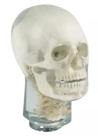 Fantôme radiographique de tête avec vertèbres cervicales Erler Zimmer