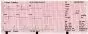 Electrocardiographe ECG Vétérinaire Edan VE300 (3 pistes)