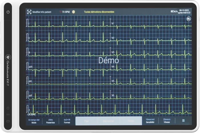  Electrocardiographe ECG Cardiomate EVI  (12 pistes) avec interprétation Spengler