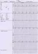 Electrocardiographe ECG Vétérinaire Edan VE300 (3 pistes)