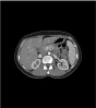 Fantôme abdomen pour tomodensitométrie radiographie et radiothérapie Erler Zimmer