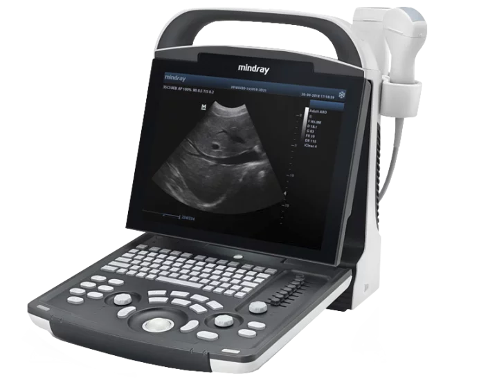 Echographe numérique portable à ultrasons Mindray DP-20