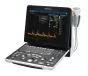 Echographe portable à ultrasons MINDRAY DP-50 Expert (couleur)