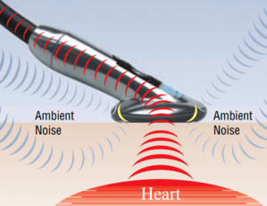 stethoscope-littmann-reduction-bruits-ambiants stethoscope-littmann-reduction-bruits-ambiants