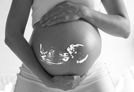 Femme Enceinte À L'aide D'un Stéthoscope Pour Entendre Le Coeur De Son Bébé  Banque D'Images et Photos Libres De Droits. Image 57547410